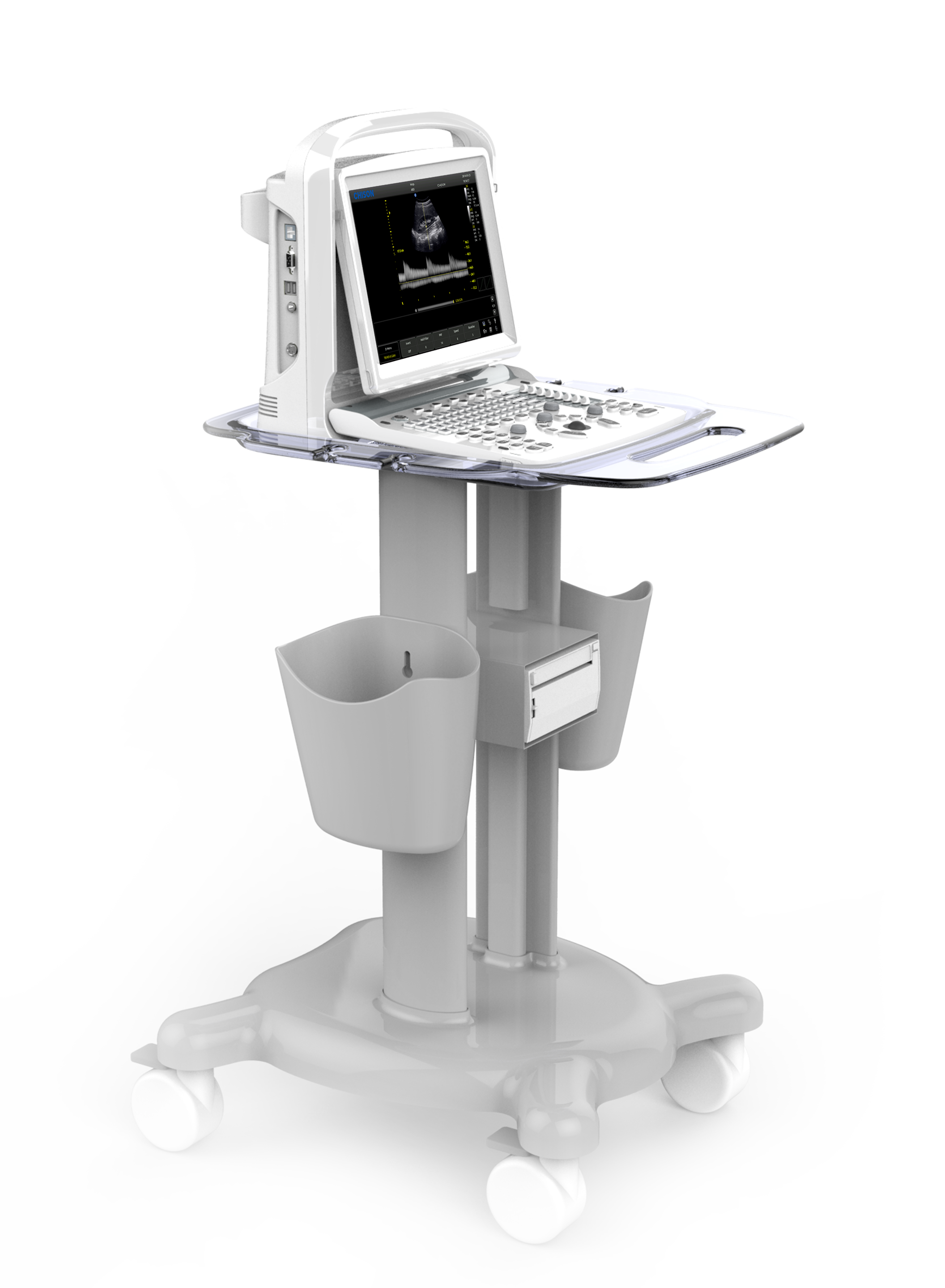 X-Ray